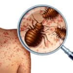 Why Do Bed Bugs Exist?